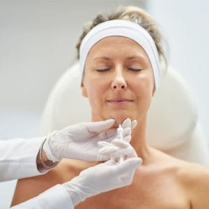 Ácido hialurinico mentón