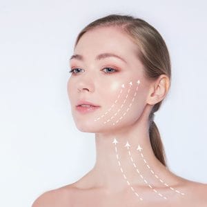 Hilos tensores en rostro