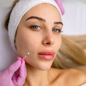 Hilos bioestimuladores de colageno