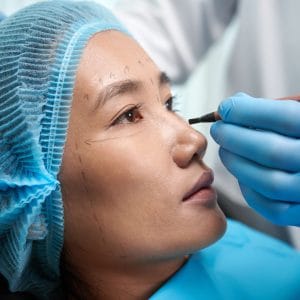 Blefaroplastia (Cirugía de Párpados) Inferior